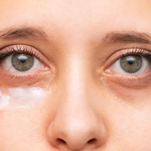 0_A-young-woman-touching-a-skin-of-her-face-while-applying-the-cream-for-black-eyes