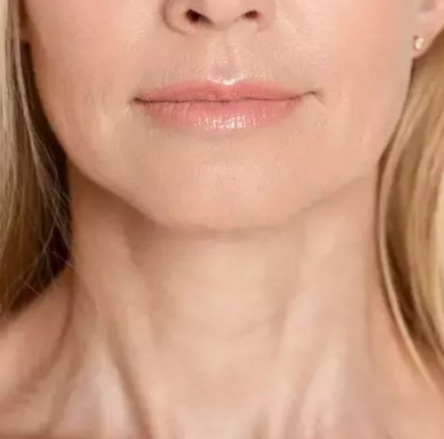 Close-up of a woman's neck-Life massage and wellness. (firming neck treatment)