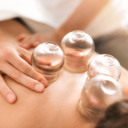 (Cupping Portsmouth)